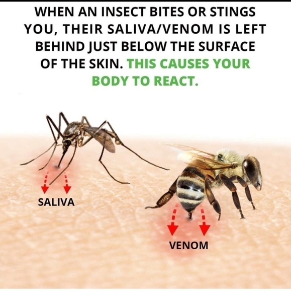 Bug Bite Thing Set Of 2 Insect Sting Relief Tool New Reusable - Picture 3 of 9